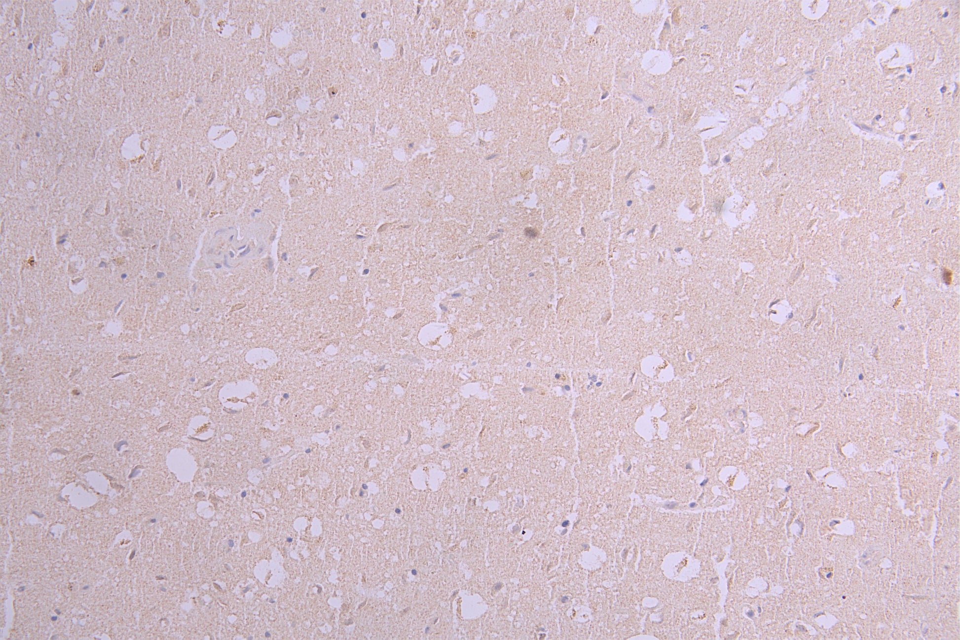IHC image of RAC08001 diluted at 1ï¼50 and staining in paraffin-embedded human brain tissue performed on a Leica BondTM system. After dewaxing and hydration, antigen retrieval was mediated by high pressure in a citrate buffer (pH 6.0). Section was blocked with 10% normal goat serum 30min at RT. Then primary antibody (1% BSA) was incubated at 4Â°C overnight. The primary is detected by a Goat anti-human polymer IgG labeled by HRP and visualized using 0.05% DAB.
