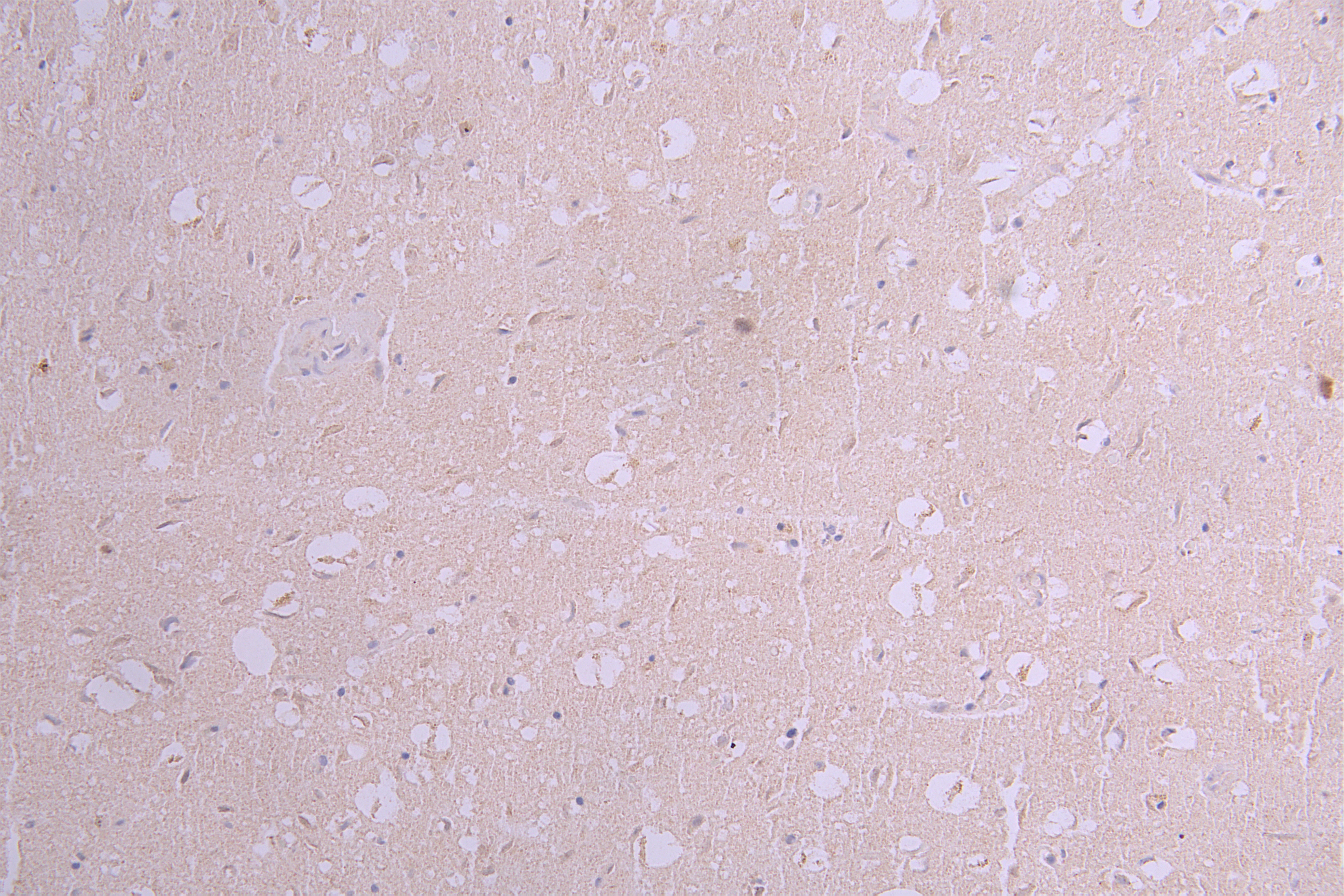 IHC image of RAC08001 diluted at 1ï¼50 and staining in paraffin-embedded human brain tissue performed on a Leica BondTM system. After dewaxing and hydration, antigen retrieval was mediated by high pressure in a citrate buffer (pH 6.0). Section was blocked with 10% normal goat serum 30min at RT. Then primary antibody (1% BSA) was incubated at 4Â°C overnight. The primary is detected by a Goat anti-human polymer IgG labeled by HRP and visualized using 0.05% DAB.