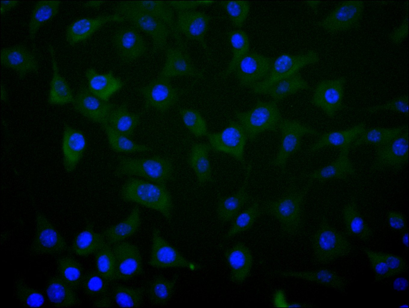 ImmunofluorescenceÂ stainingÂ ofÂ SH-SY5YÂ cellÂ withÂ RAC08001Â atÂ 1:20,Â counter-stainedÂ withÂ DAPI.Â TheÂ cellsÂ wereÂ fixedÂ inÂ 4%Â formaldehydeÂ andÂ blockedÂ inÂ 10%Â normalÂ GoatÂ Serum.Â TheÂ cellsÂ wereÂ thenÂ incubatedÂ withÂ theÂ antibodyÂ overnightÂ atÂ 4C.Â TheÂ secondaryÂ antibodyÂ wasÂ FITC-conjugatedÂ AffiniPureÂ GoatÂ Anti-HumanÂ IgG(H+L).