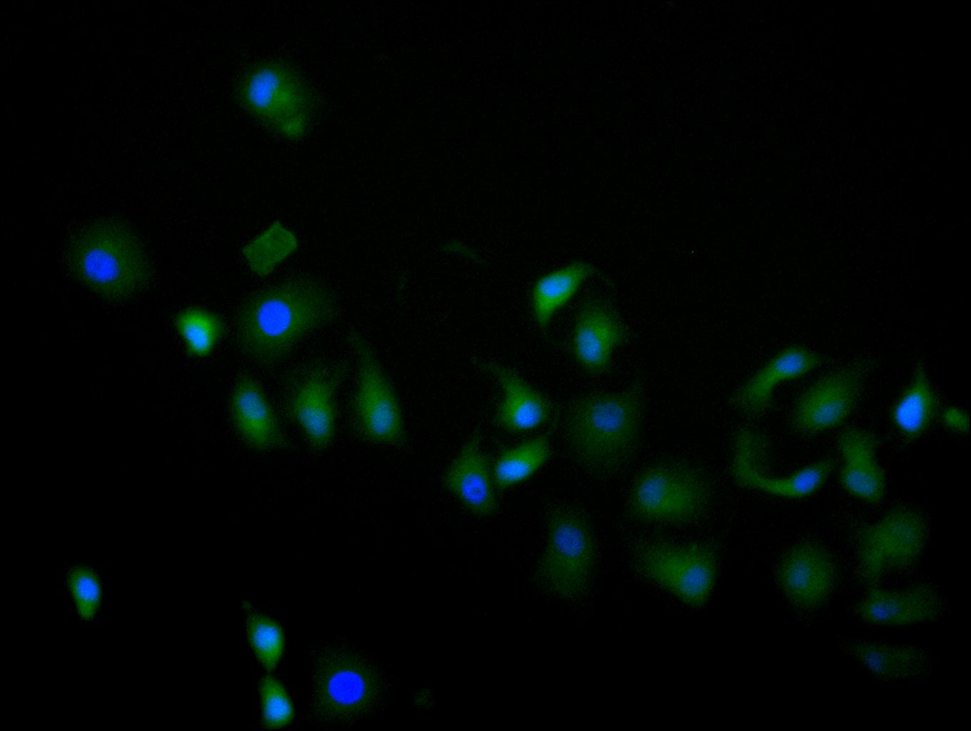 ImmunofluorescenceÂ stainingÂ ofÂ helaÂ cellÂ withÂ RAC08002Â atÂ 1:60,Â counter-stainedÂ withÂ DAPI.Â TheÂ cellsÂ wereÂ fixedÂ inÂ 4%Â formaldehydeÂ andÂ blockedÂ inÂ 10%Â normalÂ GoatÂ Serum.Â TheÂ cellsÂ wereÂ thenÂ incubatedÂ withÂ theÂ antibodyÂ overnightÂ atÂ 4C.Â TheÂ secondaryÂ antibodyÂ wasÂ FITC-conjugatedÂ AffiniPureÂ GoatÂ Anti-HumanÂ IgG(H+L).