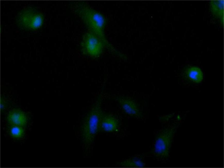 ImmunofluorescenceÂ stainingÂ ofÂ U251Â cellÂ withÂ RAC08002Â atÂ 1:60,Â counter-stainedÂ withÂ DAPI.Â TheÂ cellsÂ wereÂ fixedÂ inÂ 4%Â formaldehydeÂ andÂ blockedÂ inÂ 10%Â normalÂ GoatÂ Serum.Â TheÂ cellsÂ wereÂ thenÂ incubatedÂ withÂ theÂ antibodyÂ overnightÂ atÂ 4C.Â TheÂ secondaryÂ antibodyÂ wasÂ FITC-conjugatedÂ AffiniPureÂ GoatÂ Anti-HumanÂ IgG(H+L).