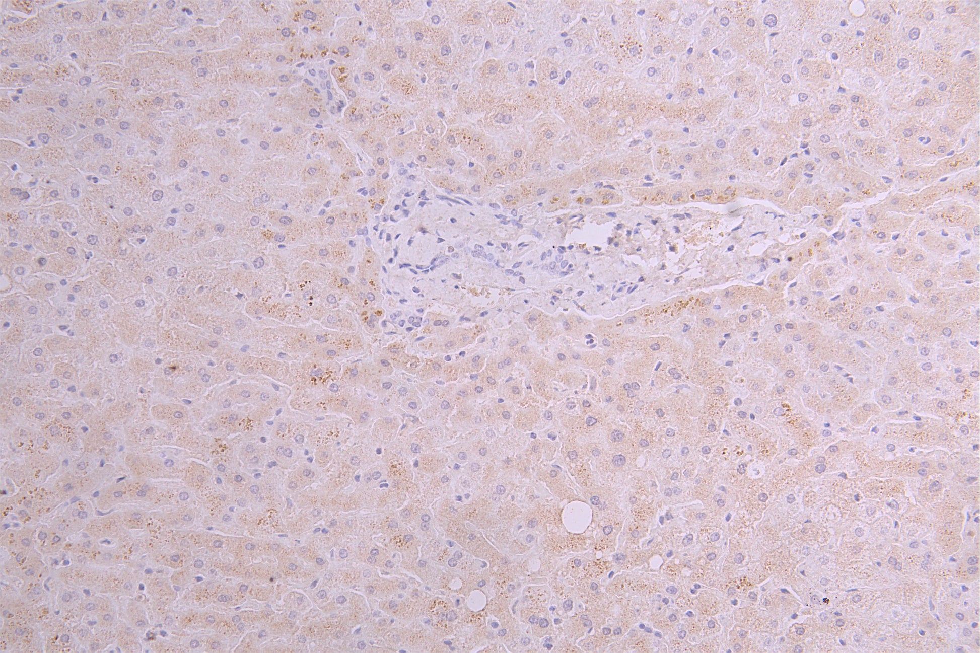 IHC image of RAC08004 diluted at 1ï¼100 and staining in paraffin-embedded human liver tissue performed on a Leica BondTM system. After dewaxing and hydration, antigen retrieval was mediated by high pressure in a citrate buffer (pH 6.0). Section was blocked with 10% normal goat serum 30min at RT. Then primary antibody (1% BSA) was incubated at 4Â°C overnight. The primary is detected by a Goat anti-human polymer IgG labeled by HRP and visualized using 0.05% DAB.