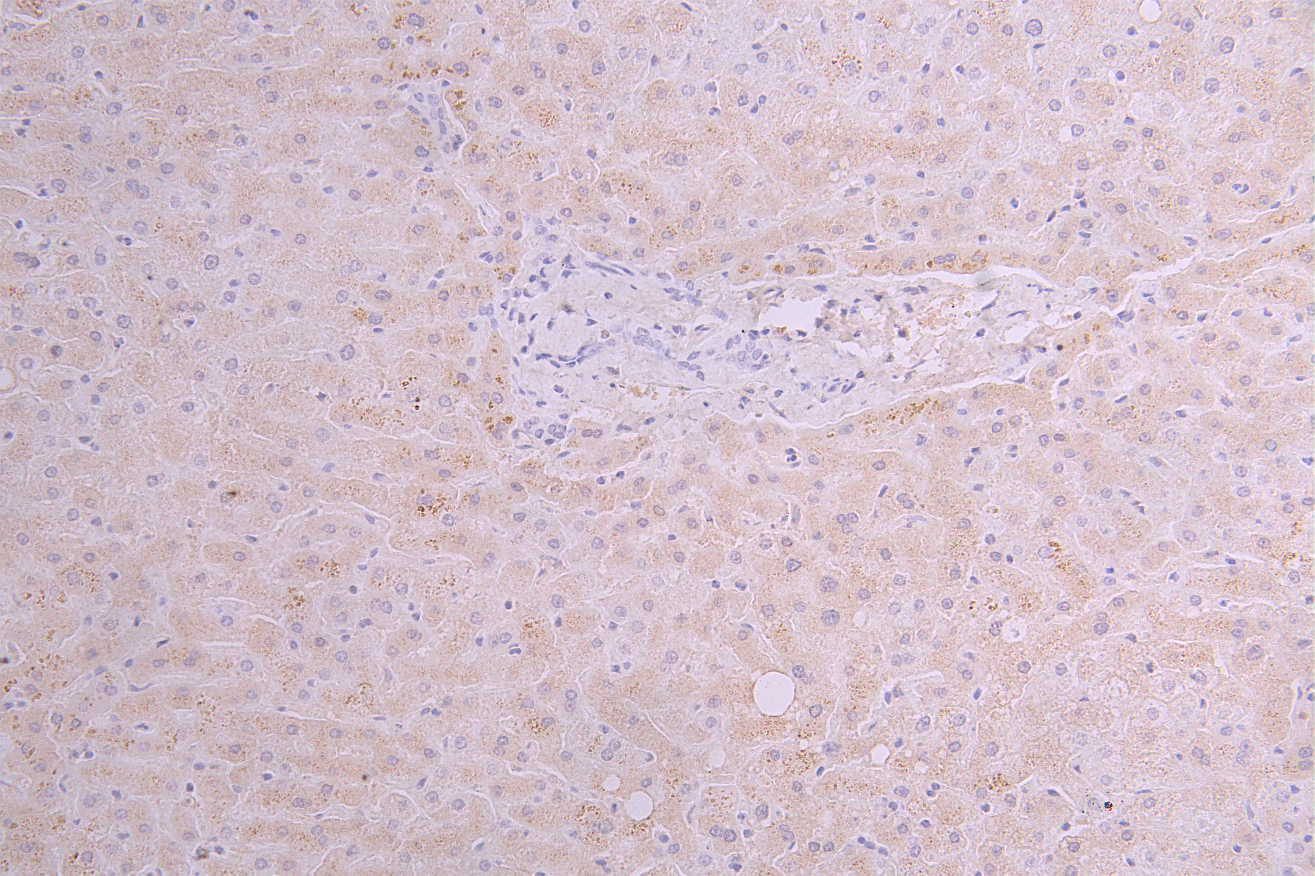 IHC image of RAC08004 diluted at 1ï¼100 and staining in paraffin-embedded human liver tissue performed on a Leica BondTM system. After dewaxing and hydration, antigen retrieval was mediated by high pressure in a citrate buffer (pH 6.0). Section was blocked with 10% normal goat serum 30min at RT. Then primary antibody (1% BSA) was incubated at 4Â°C overnight. The primary is detected by a Goat anti-human polymer IgG labeled by HRP and visualized using 0.05% DAB.