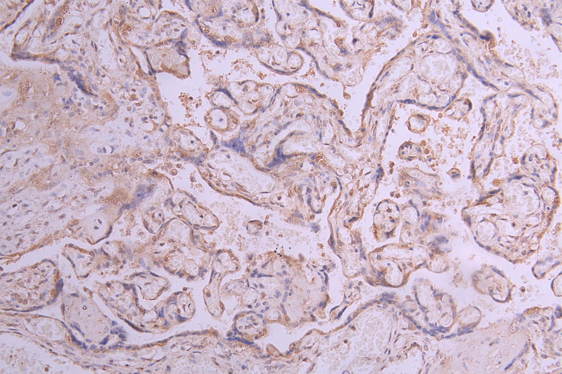IHC image of RAC08008 diluted at 1:50 and staining in paraffin-embedded human placenta tissue performed on a Leica BondTM system. After dewaxing and hydration, antigen retrieval was mediated by high pressure in a citrate buffer (pH 6.0). Section was blocked with 10% normal goat serum 30min at RT. Then primary antibody (1% BSA) was incubated at 4Â°C overnight. The primary is detected by a Goat anti-human polymer IgG labeled by HRP and visualized using 0.05% DAB.