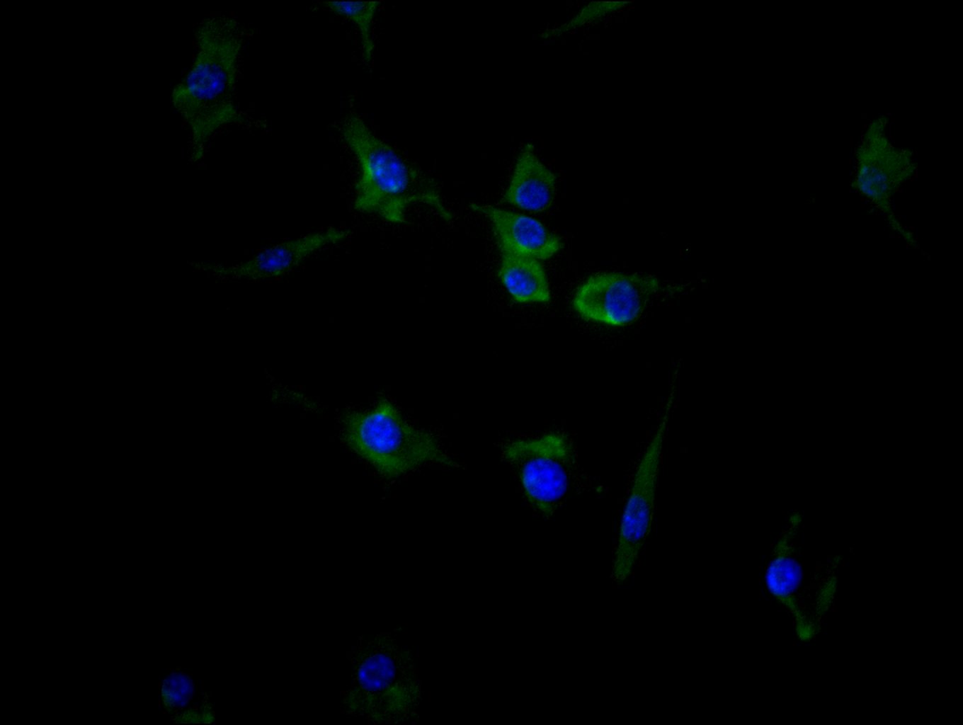 ImmunofluorescenceÂ stainingÂ ofÂ SH-SY5YÂ cellÂ withÂ RAC08010Â atÂ 1:100,Â counter-stainedÂ withÂ DAPI.Â TheÂ cellsÂ wereÂ fixedÂ inÂ 4%Â formaldehydeÂ andÂ blockedÂ inÂ 10%Â normalÂ GoatÂ Serum.Â TheÂ cellsÂ wereÂ thenÂ incubatedÂ withÂ theÂ antibodyÂ overnightÂ atÂ 4C.Â TheÂ secondaryÂ antibodyÂ wasÂ FITC-conjugatedÂ AffiniPureÂ GoatÂ Anti-HumanÂ IgG(H+L).