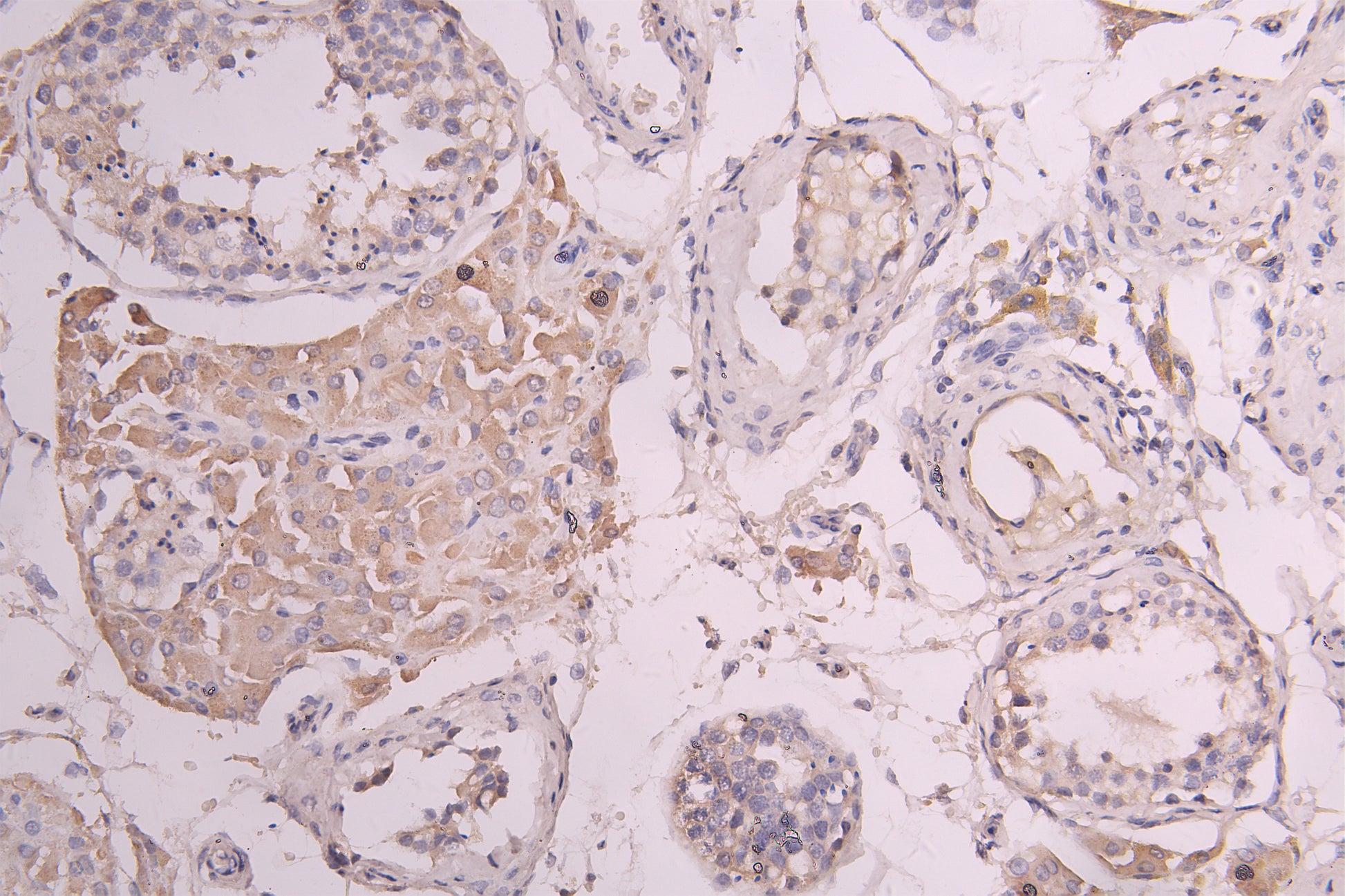IHC image of RAC08011 diluted at 1ï¼100 and staining in paraffin-embedded human testis tissue performed on a Leica BondTM system. After dewaxing and hydration, antigen retrieval was mediated by high pressure in a citrate buffer (pH 6.0). Section was blocked with 10% normal goat serum 30min at RT. Then primary antibody (1% BSA) was incubated at 4Â°C overnight. The primary is detected by a Goat anti-human polymer IgG labeled by HRP and visualized using 0.05% DAB.