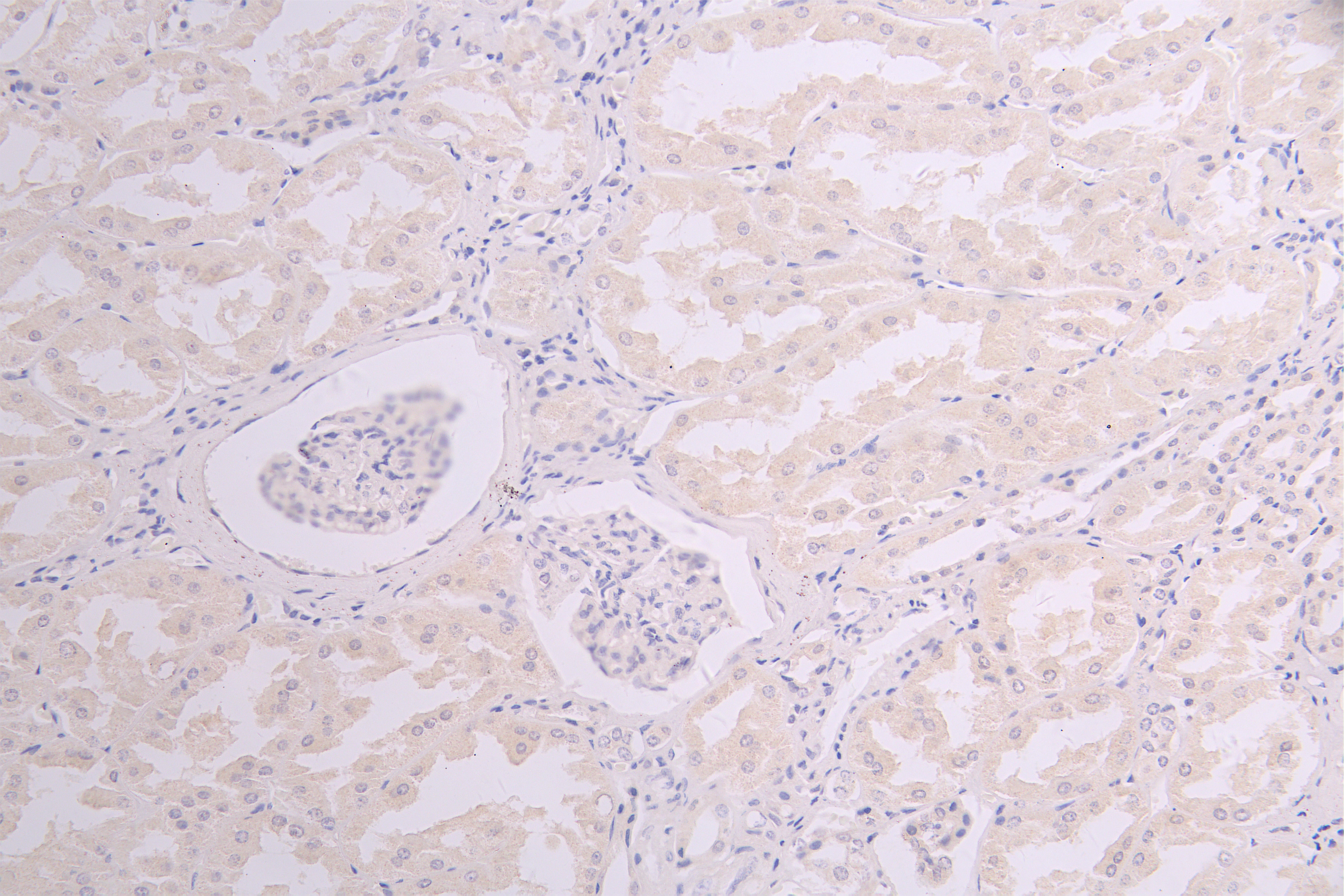 IHC image of RAC08012 diluted at 1ï¼100 and staining in paraffin-embedded human kidney tissue performed on a Leica BondTM system. After dewaxing and hydration, antigen retrieval was mediated by high pressure in a citrate buffer (pH 6.0). Section was blocked with 10% normal goat serum 30min at RT. Then primary antibody (1% BSA) was incubated at 4Â°C overnight. The primary is detected by a Goat anti-human polymer IgG labeled by HRP and visualized using 0.05% DAB.