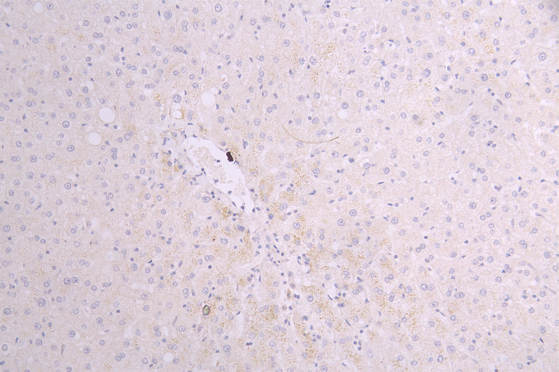 IHC image of RAC08012 diluted at 1ï¼100 and staining in paraffin-embedded human liver tissue performed on a Leica BondTM system. After dewaxing and hydration, antigen retrieval was mediated by high pressure in a citrate buffer (pH 6.0). Section was blocked with 10% normal goat serum 30min at RT. Then primary antibody (1% BSA) was incubated at 4Â°C overnight. The primary is detected by a Goat anti-human polymer IgG labeled by HRP and visualized using 0.05% DAB.