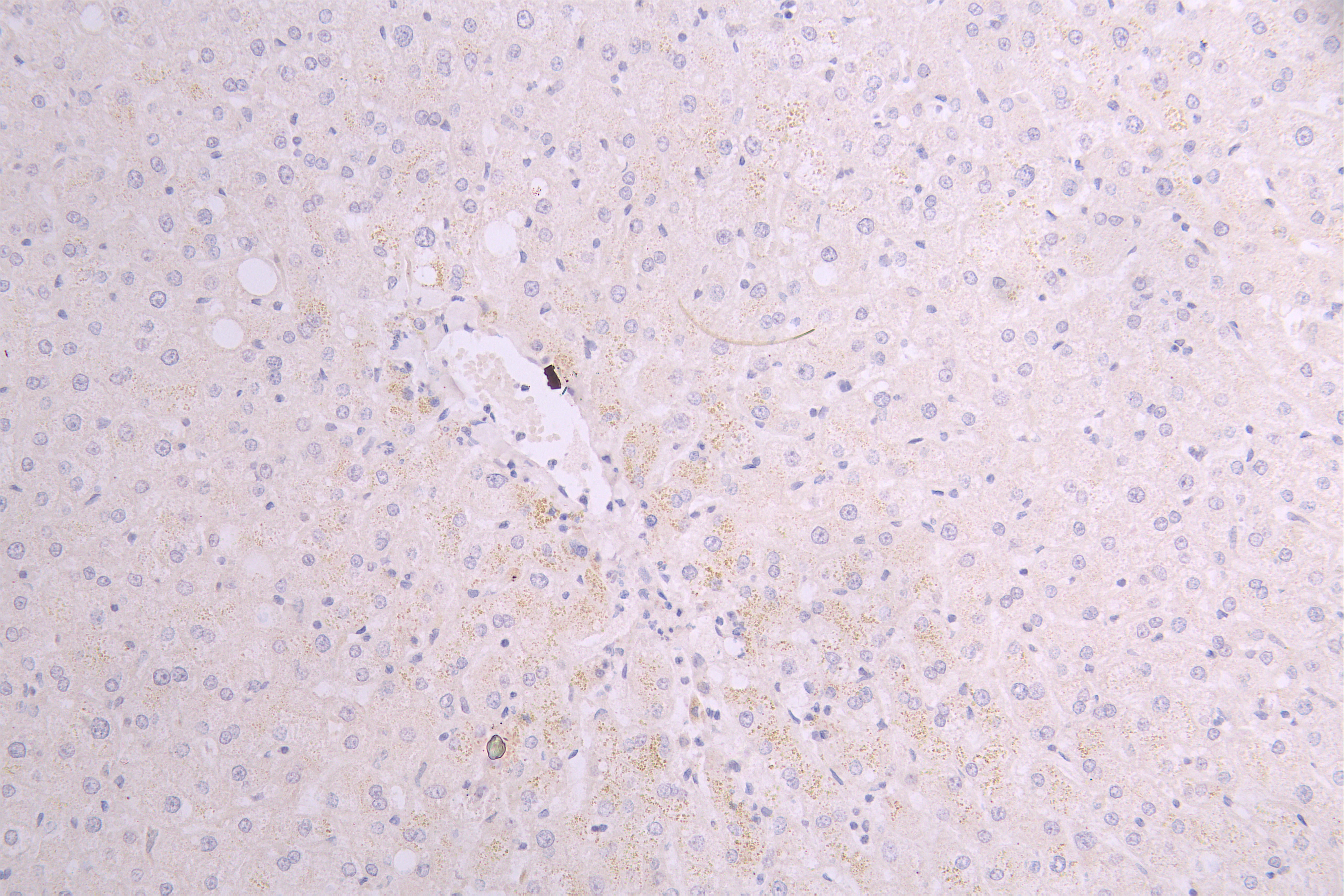 IHC image of RAC08012 diluted at 1ï¼100 and staining in paraffin-embedded human liver tissue performed on a Leica BondTM system. After dewaxing and hydration, antigen retrieval was mediated by high pressure in a citrate buffer (pH 6.0). Section was blocked with 10% normal goat serum 30min at RT. Then primary antibody (1% BSA) was incubated at 4Â°C overnight. The primary is detected by a Goat anti-human polymer IgG labeled by HRP and visualized using 0.05% DAB.