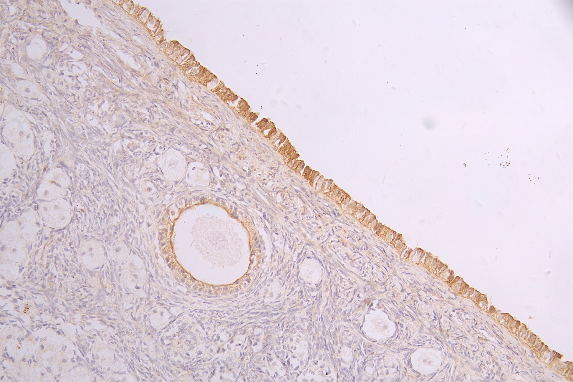 IHC image of RAC08014 diluted at 1ï¼100 and staining in paraffin-embedded human ovarian tissue performed on a Leica BondTM system. After dewaxing and hydration, antigen retrieval was mediated by high pressure in a citrate buffer (pH 6.0). Section was blocked with 10% normal goat serum 30min at RT. Then primary antibody (1% BSA) was incubated at 4Â°C overnight. The primary is detected by a Goat anti-human polymer IgG labeled by HRP and visualized using 0.05% DAB.