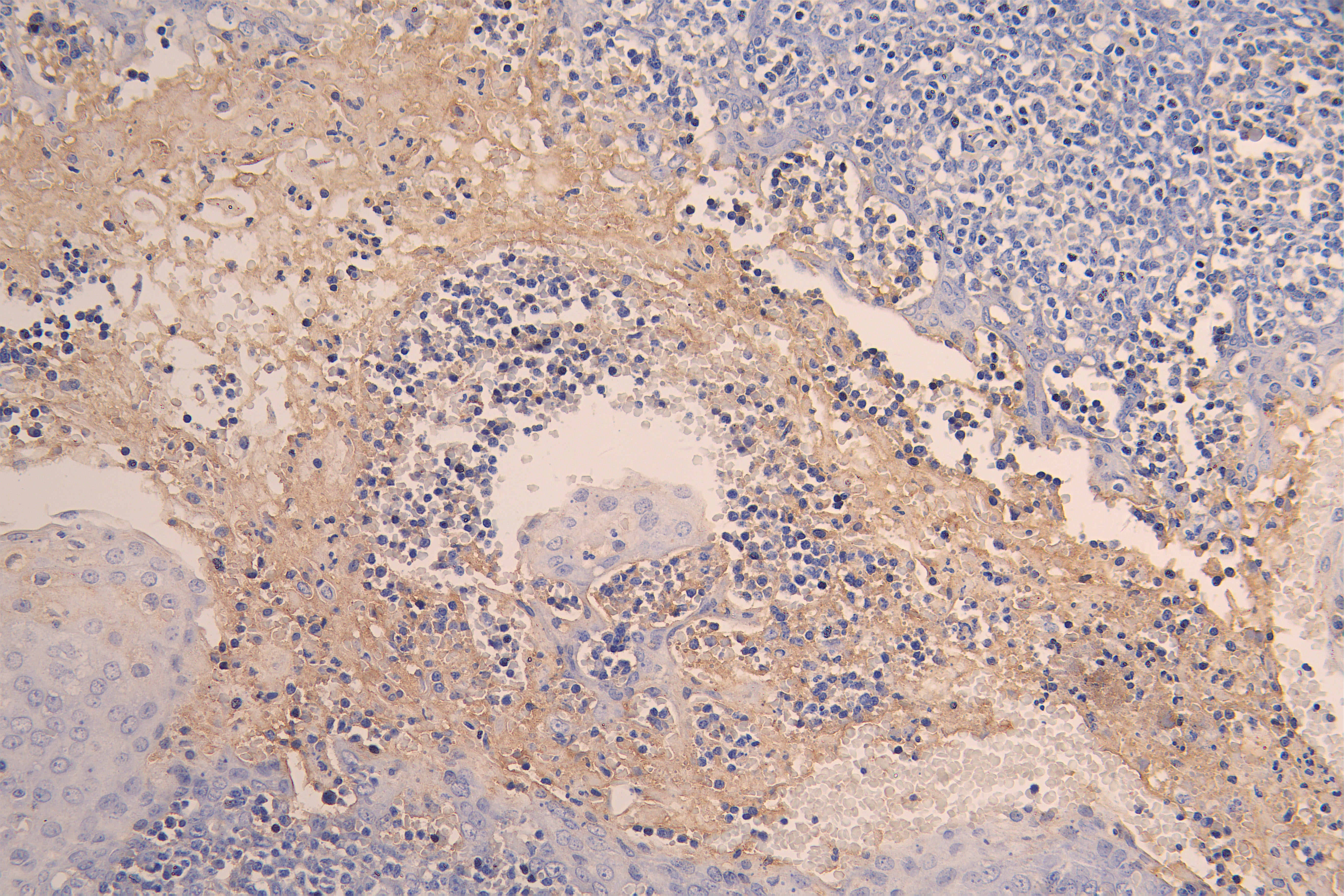 IHC image of RAC08017 diluted at 1:200 and staining in paraffin-embedded human tonsil tissue performed on a Leica BondTM system. After dewaxing and hydration, antigen retrieval was mediated by high pressure in a citrate buffer (pH 6.0). Section was blocked with 10% normal goat serum 30min at RT. Then primary antibody (1% BSA) was incubated at 4Â°C overnight. The primary is detected by a Goat anti-human polymer IgG labeled by HRP and visualized using 0.05% DAB.