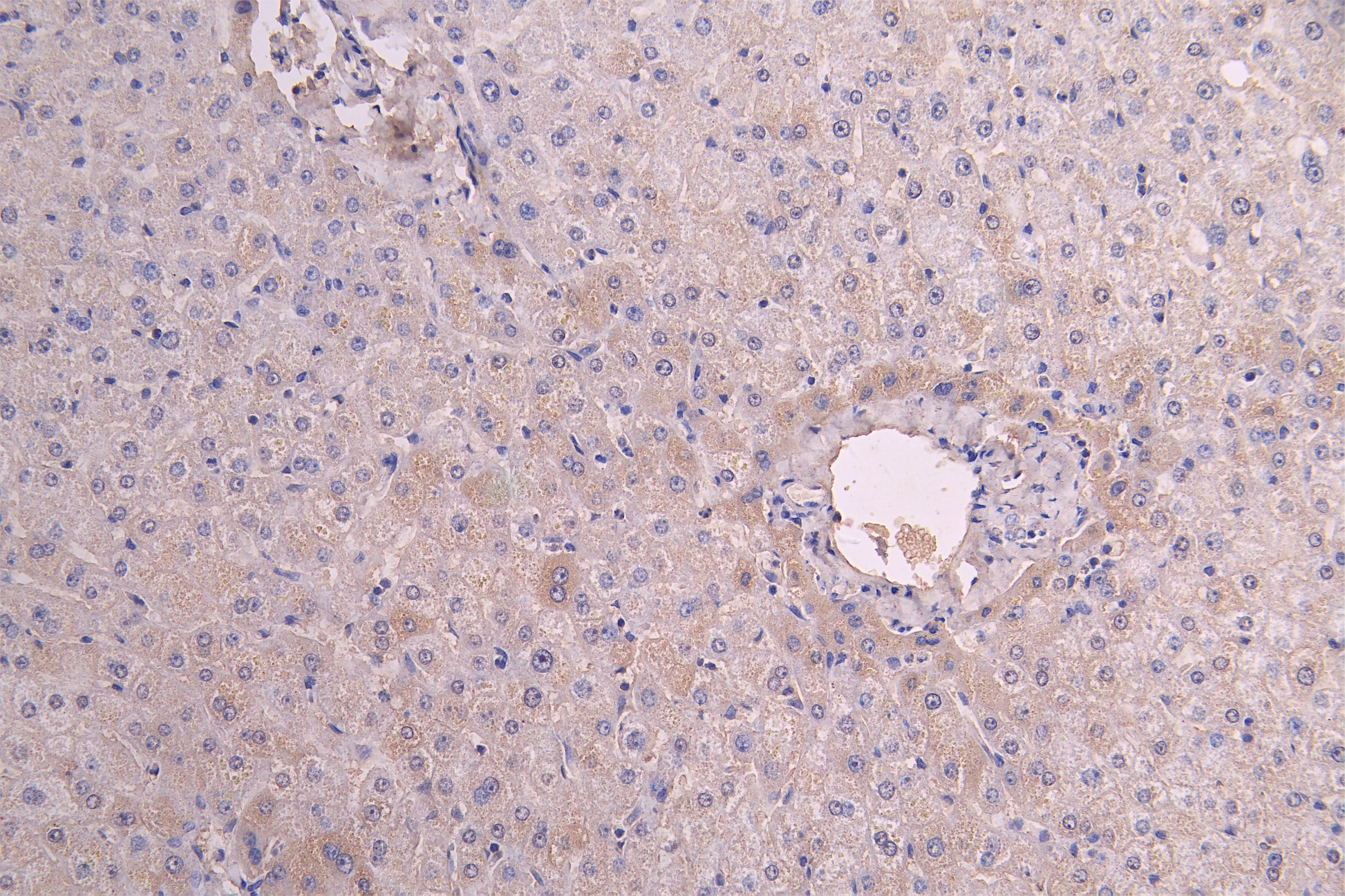 IHC image of RAC08018 diluted at 1:200 and staining in paraffin-embedded human liver tissue performed on a Leica BondTM system. After dewaxing and hydration, antigen retrieval was mediated by high pressure in a citrate buffer (pH 6.0). Section was blocked with 10% normal goat serum 30min at RT. Then primary antibody (1% BSA) was incubated at 4Â°C overnight. The primary is detected by a Goat anti-human polymer IgG labeled by HRP and visualized using 0.05% DAB.