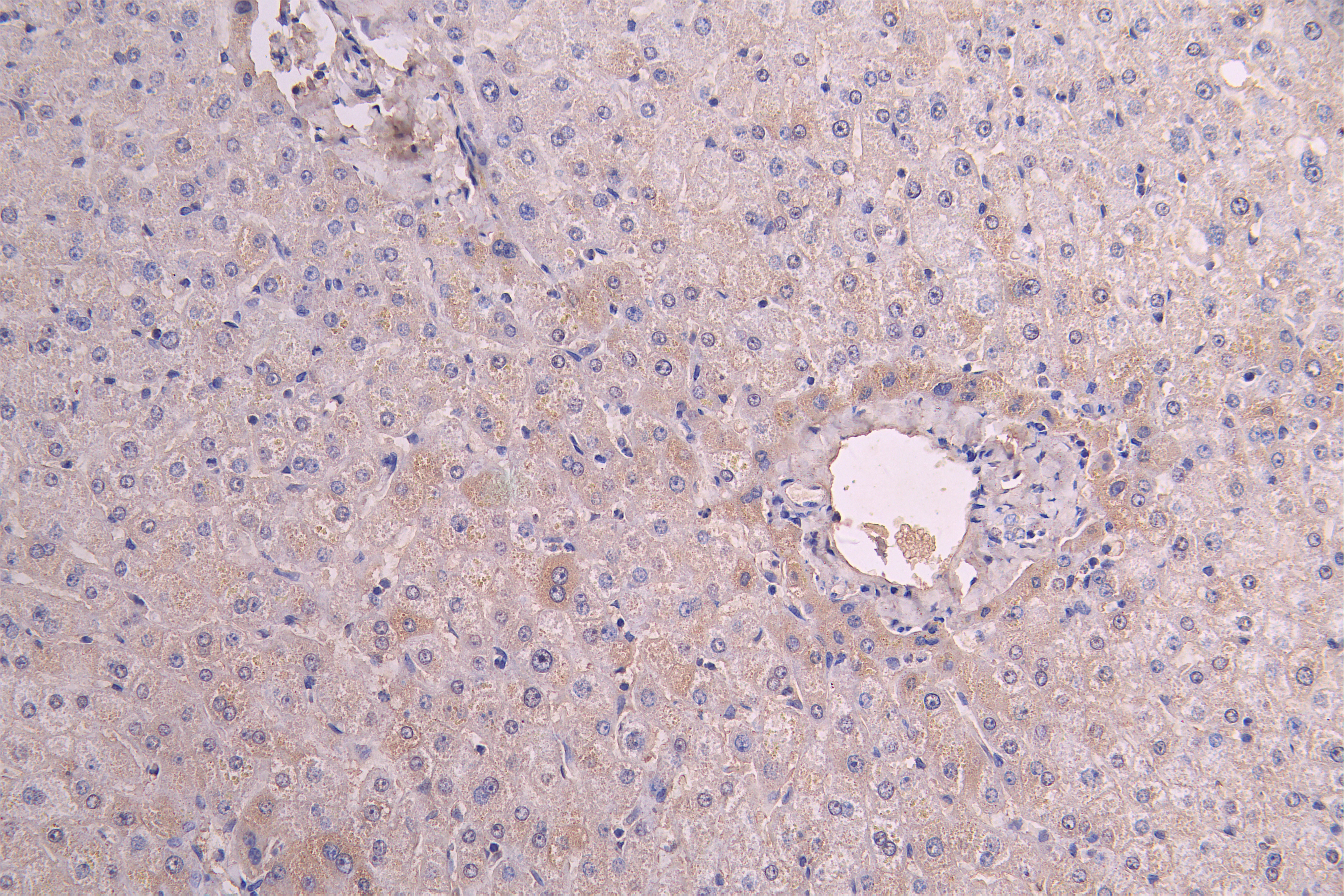 IHC image of RAC08018 diluted at 1:200 and staining in paraffin-embedded human liver tissue performed on a Leica BondTM system. After dewaxing and hydration, antigen retrieval was mediated by high pressure in a citrate buffer (pH 6.0). Section was blocked with 10% normal goat serum 30min at RT. Then primary antibody (1% BSA) was incubated at 4Â°C overnight. The primary is detected by a Goat anti-human polymer IgG labeled by HRP and visualized using 0.05% DAB.
