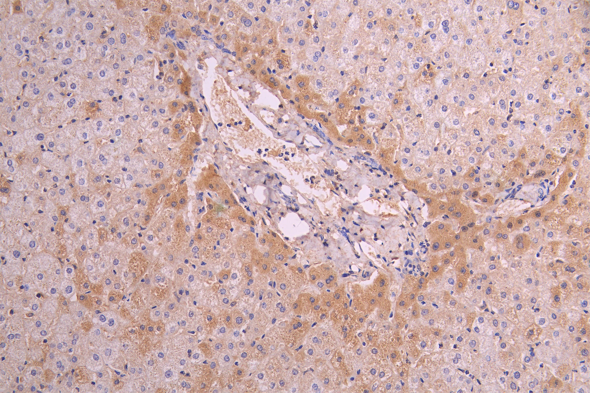 IHC image of RAC08022 diluted at 1ï¼100 and staining in paraffin-embedded human liver tissue performed on a Leica BondTM system. After dewaxing and hydration, antigen retrieval was mediated by high pressure in a citrate buffer (pH 6.0). Section was blocked with 10% normal goat serum 30min at RT. Then primary antibody (1% BSA) was incubated at 4Â°C overnight. The primary is detected by a Goat anti-human polymer IgG labeled by HRP and visualized using 0.05% DAB.