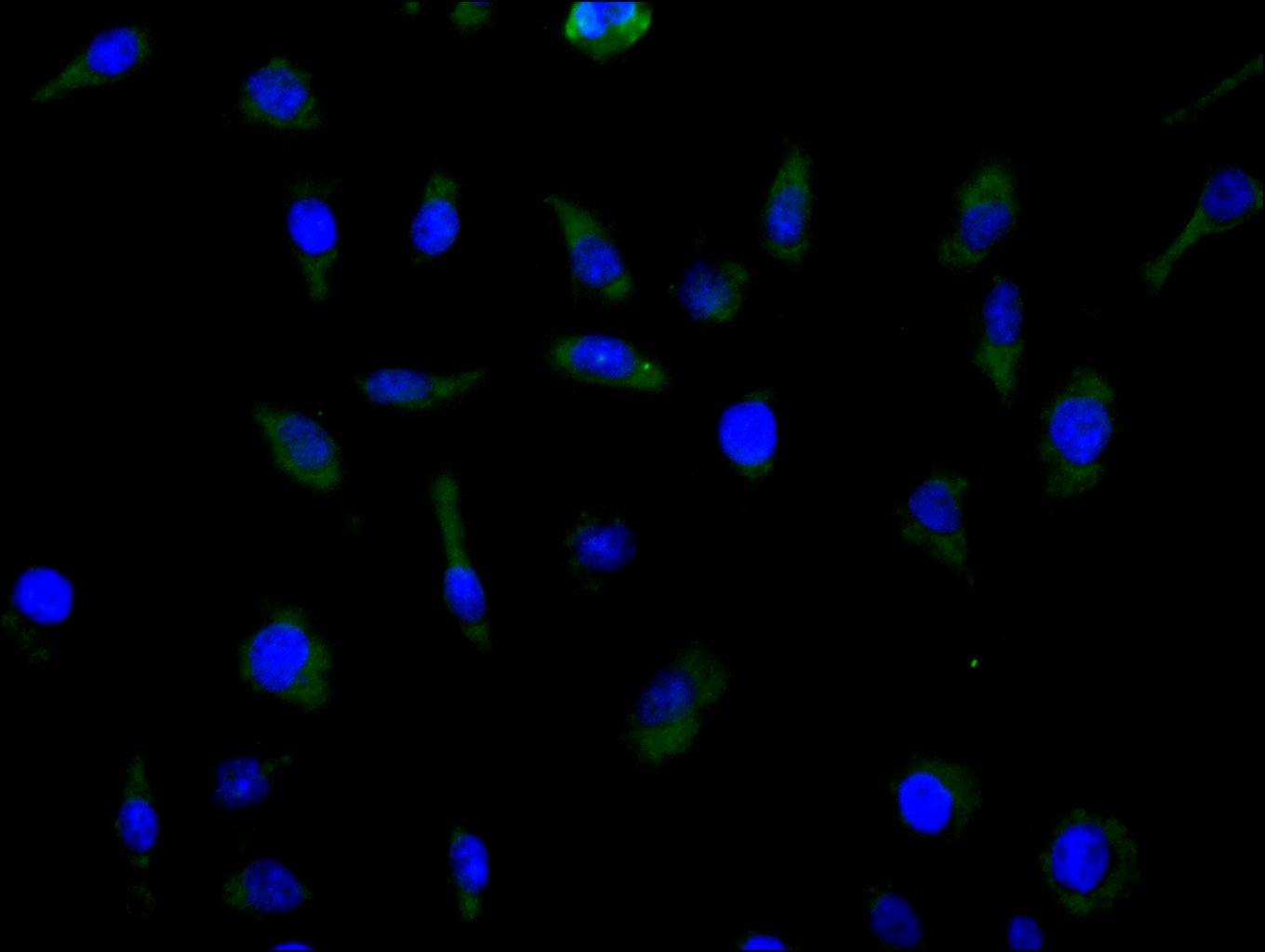 ImmunofluorescenceÂ stainingÂ ofÂ MCFÂ cellÂ withÂ RAC08023Â atÂ 1:100,Â counter-stainedÂ withÂ DAPI.Â TheÂ cellsÂ wereÂ fixedÂ inÂ 4%Â formaldehydeÂ andÂ blockedÂ inÂ 10%Â normalÂ GoatÂ Serum.Â TheÂ cellsÂ wereÂ thenÂ incubatedÂ withÂ theÂ antibodyÂ overnightÂ atÂ 4C.Â TheÂ secondaryÂ antibodyÂ wasÂ FITC-conjugatedÂ AffiniPureÂ GoatÂ Anti-HumanÂ IgG(H+L).