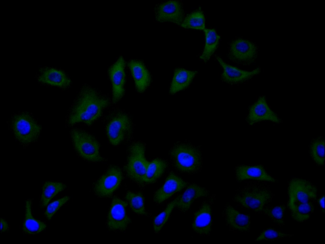 ImmunofluorescenceÂ stainingÂ ofÂ HelaÂ cellÂ withÂ RAC08023Â atÂ 1:100,Â counter-stainedÂ withÂ DAPI.Â TheÂ cellsÂ wereÂ fixedÂ inÂ 4%Â formaldehydeÂ andÂ blockedÂ inÂ 10%Â normalÂ GoatÂ Serum.Â TheÂ cellsÂ wereÂ thenÂ incubatedÂ withÂ theÂ antibodyÂ overnightÂ atÂ 4C.Â TheÂ secondaryÂ antibodyÂ wasÂ FITC-conjugatedÂ AffiniPureÂ GoatÂ Anti-HumanÂ IgG(H+L).