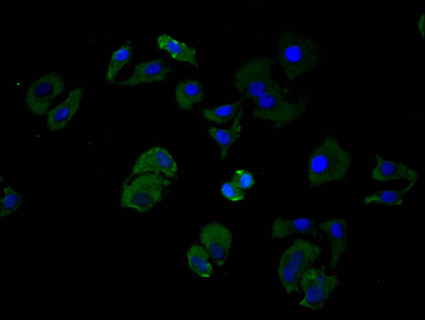 ImmunofluorescenceÂ stainingÂ ofÂ HelaÂ cellÂ withÂ RAC08026Â atÂ 1:25,Â counter-stainedÂ withÂ DAPI.Â TheÂ cellsÂ wereÂ fixedÂ inÂ 4%Â formaldehydeÂ andÂ blockedÂ inÂ 10%Â normalÂ GoatÂ Serum.Â TheÂ cellsÂ wereÂ thenÂ incubatedÂ withÂ theÂ antibodyÂ overnightÂ atÂ 4C.Â TheÂ secondaryÂ antibodyÂ wasÂ FITC-conjugatedÂ AffiniPureÂ GoatÂ Anti-HumanÂ IgG(H+L).