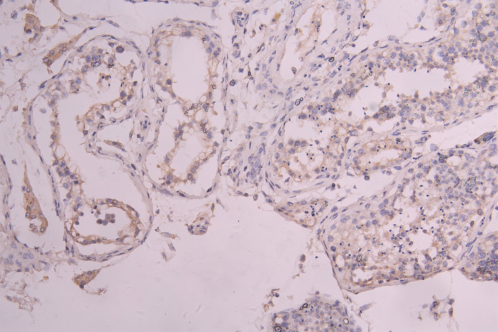 IHC image of RAC08027 diluted at 1ï¼100 and staining in paraffin-embedded human testis tissue performed on a Leica BondTM system. After dewaxing and hydration, antigen retrieval was mediated by high pressure in a citrate buffer (pH 6.0). Section was blocked with 10% normal goat serum 30min at RT. Then primary antibody (1% BSA) was incubated at 4Â°C overnight. The primary is detected by a Goat anti-human polymer IgG labeled by HRP and visualized using 0.05% DAB.