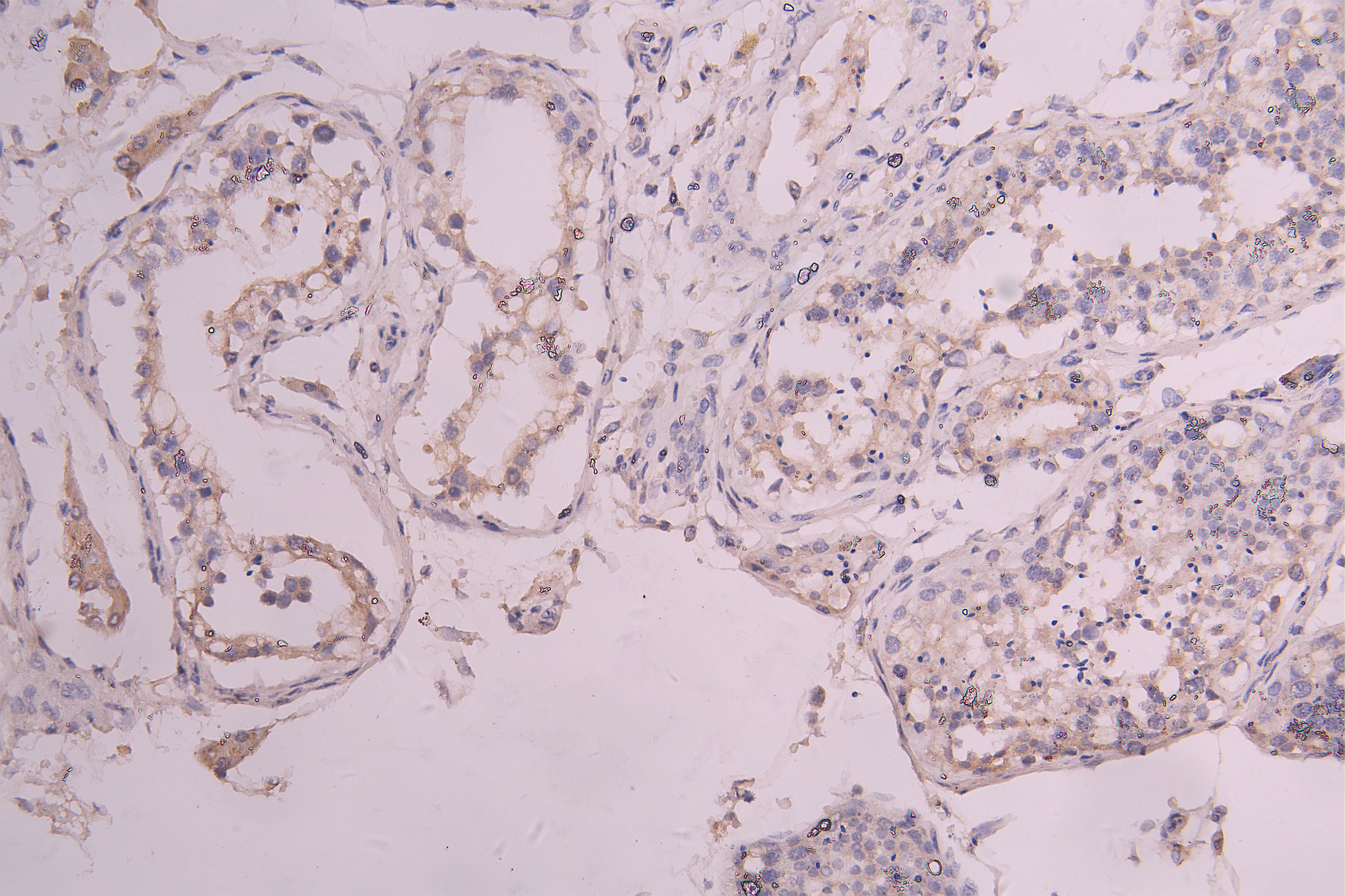 IHC image of RAC08027 diluted at 1ï¼100 and staining in paraffin-embedded human testis tissue performed on a Leica BondTM system. After dewaxing and hydration, antigen retrieval was mediated by high pressure in a citrate buffer (pH 6.0). Section was blocked with 10% normal goat serum 30min at RT. Then primary antibody (1% BSA) was incubated at 4Â°C overnight. The primary is detected by a Goat anti-human polymer IgG labeled by HRP and visualized using 0.05% DAB.