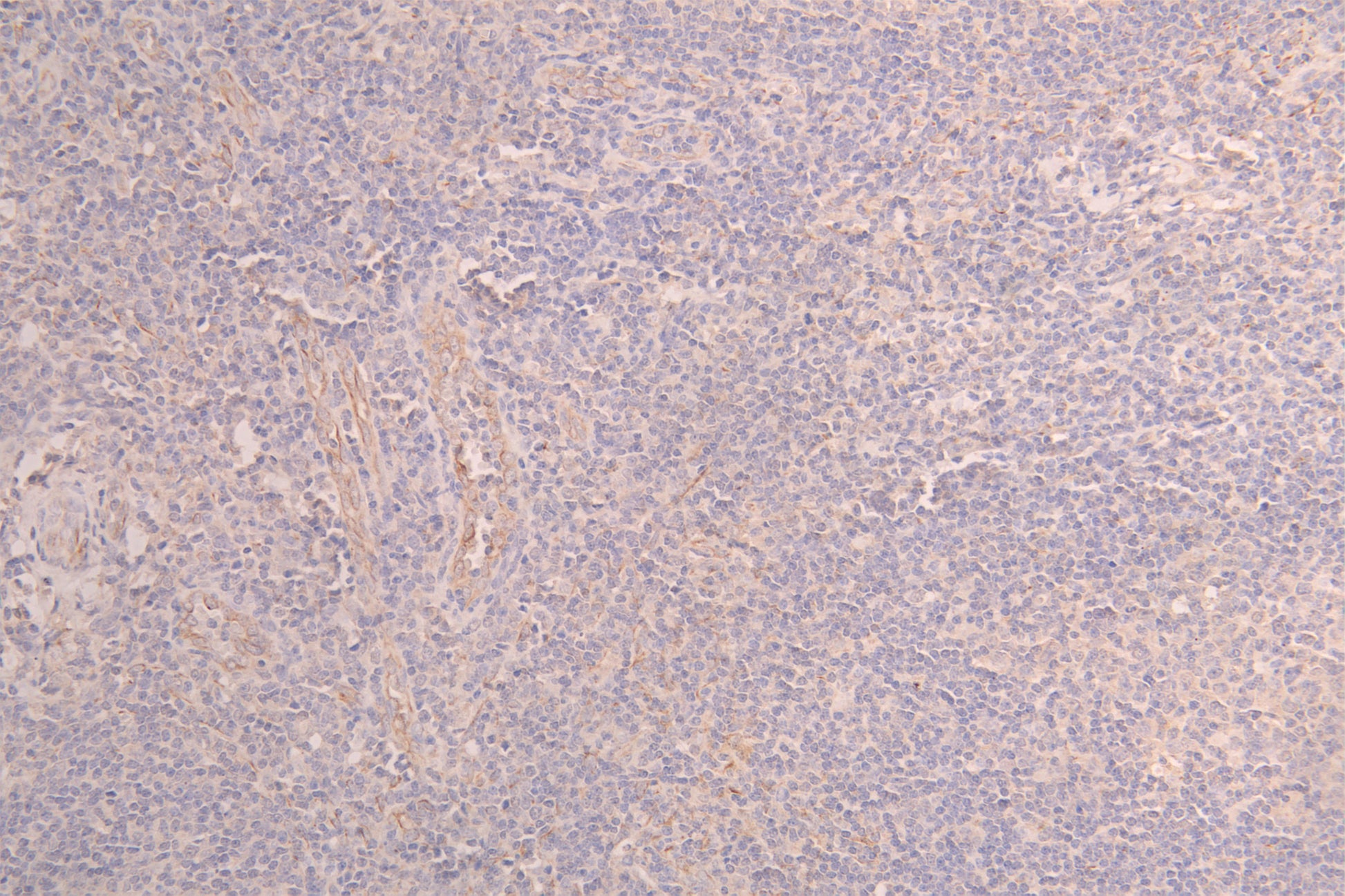 IHC image of RAC08028 diluted at 1ï¼100 and staining in paraffin-embedded human testis tissue performed on a Leica BondTM system. After dewaxing and hydration, antigen retrieval was mediated by high pressure in a citrate buffer (pH 6.0). Section was blocked with 10% normal goat serum 30min at RT. Then primary antibody (1% BSA) was incubated at 4Â°C overnight. The primary is detected by a Goat anti-human polymer IgG labeled by HRP and visualized using 0.05% DAB.
