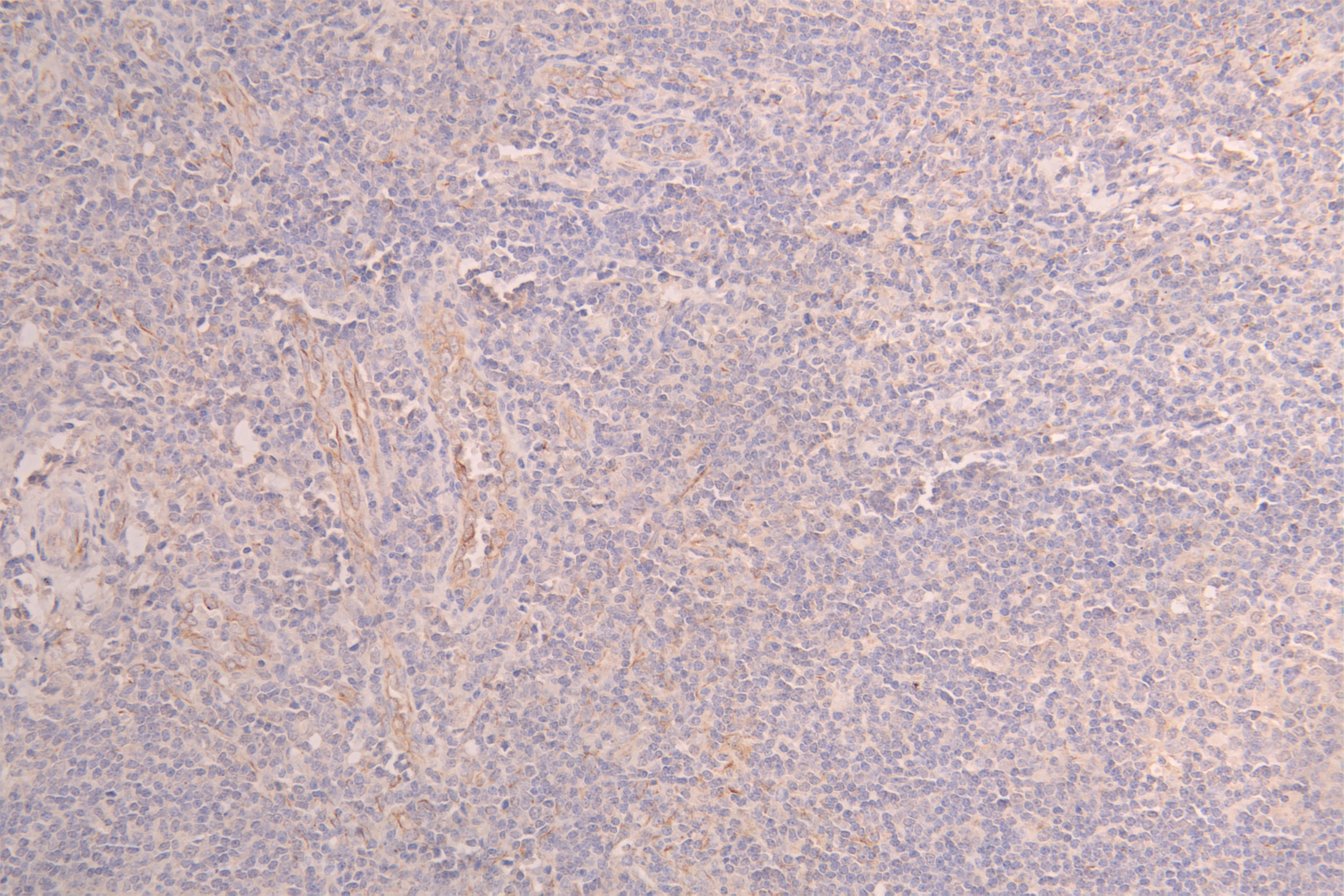 IHC image of RAC08028 diluted at 1ï¼100 and staining in paraffin-embedded human testis tissue performed on a Leica BondTM system. After dewaxing and hydration, antigen retrieval was mediated by high pressure in a citrate buffer (pH 6.0). Section was blocked with 10% normal goat serum 30min at RT. Then primary antibody (1% BSA) was incubated at 4Â°C overnight. The primary is detected by a Goat anti-human polymer IgG labeled by HRP and visualized using 0.05% DAB.
