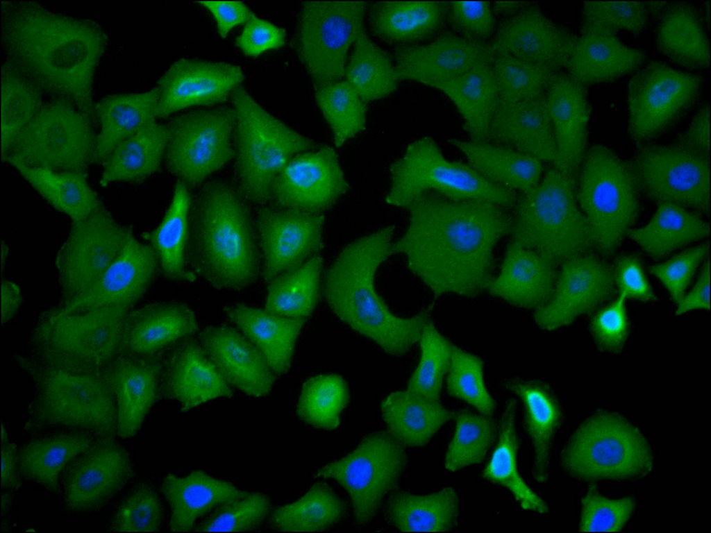 ImmunofluorescenceÂ stainingÂ ofÂ helaÂ cellÂ withÂ atÂ 1:30,Â counter-stainedÂ withÂ DAPI.Â TheÂ cellsÂ wereÂ fixedÂ inÂ 4%Â formaldehydeÂ andÂ blockedÂ inÂ 10%Â normalÂ GoatÂ Serum.Â TheÂ cellsÂ wereÂ thenÂ incubatedÂ withÂ theÂ antibodyÂ overnightÂ atÂ 4C.Â TheÂ secondaryÂ antibodyÂ wasÂ FITC-conjugatedÂ AffiniPureÂ GoatÂ Anti-RabbitÂ IgG(H+L).