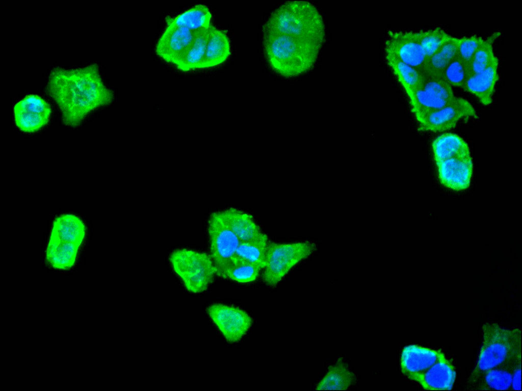 ImmunofluorescenceÂ stainingÂ ofÂ MCF7Â cellÂ withÂ atÂ 1:30,Â counter-stainedÂ withÂ DAPI.Â TheÂ cellsÂ wereÂ fixedÂ inÂ 4%Â formaldehydeÂ andÂ blockedÂ inÂ 10%Â normalÂ GoatÂ Serum.Â TheÂ cellsÂ wereÂ thenÂ incubatedÂ withÂ theÂ antibodyÂ overnightÂ atÂ 4C.Â TheÂ secondaryÂ antibodyÂ wasÂ FITC-conjugatedÂ AffiniPureÂ GoatÂ Anti-RabbitÂ IgG(H+L).