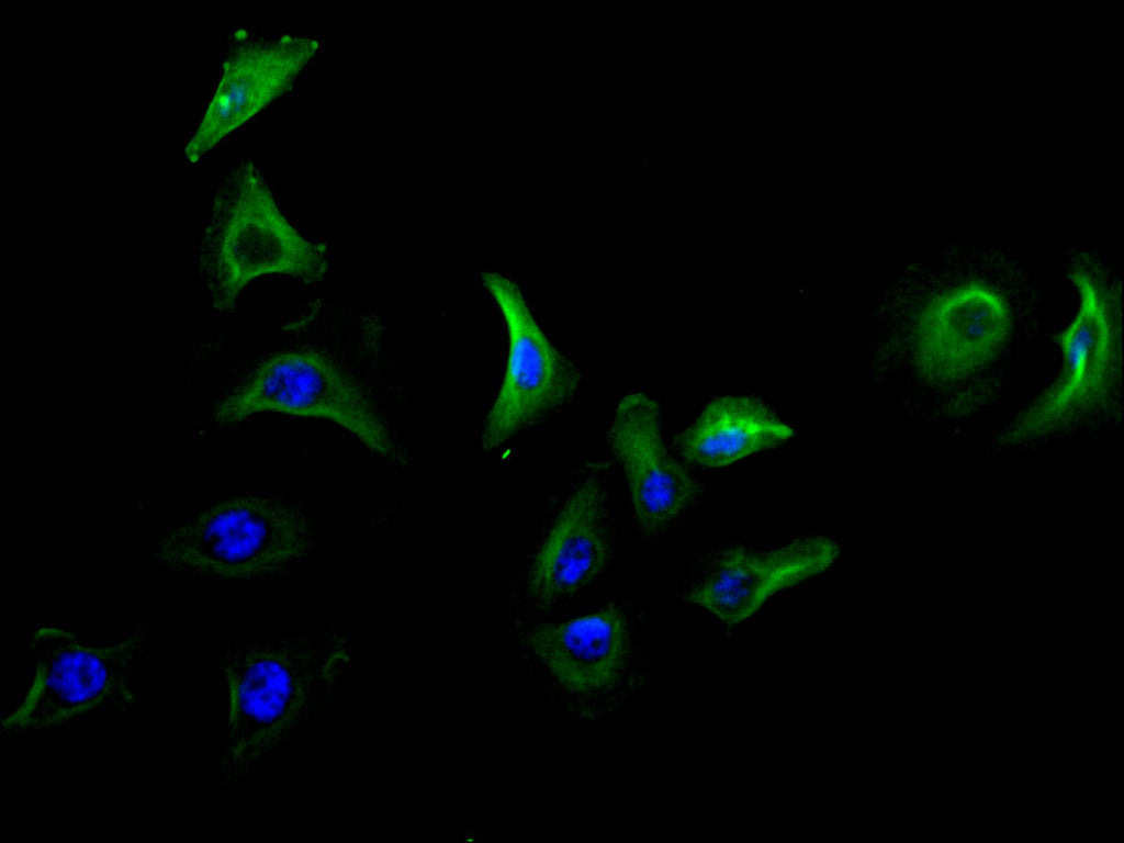 ImmunofluorescenceÂ stainingÂ ofÂ A549Â cellÂ atÂ 1:50,Â counter-stainedÂ withÂ DAPI.Â TheÂ cellsÂ wereÂ fixedÂ inÂ 4%Â formaldehydeÂ andÂ blockedÂ inÂ 10%Â normalÂ GoatÂ Serum.Â TheÂ cellsÂ wereÂ thenÂ incubatedÂ withÂ theÂ antibodyÂ overnightÂ atÂ 4C.Â TheÂ secondaryÂ antibodyÂ wasÂ FITC-conjugatedÂ AffiniPureÂ GoatÂ Anti-MouseÂ IgG(H+L).