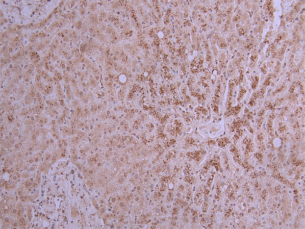 IHC image diluted at 1:200 and staining in paraffin-embedded human liver performed on a Leica BondTM system. After dewaxing and hydration, antigen retrieval was mediated by high pressure in a citrate buffer (pH 6.0). Section was blocked with 10% normal goat serum 30min at RT. Then primary antibody (1% BSA) was incubated at 4Â°C overnight. The primary is detected by a Goat anti-mouse polymer IgG labeled by HRP and visualized using 0.05% DAB.