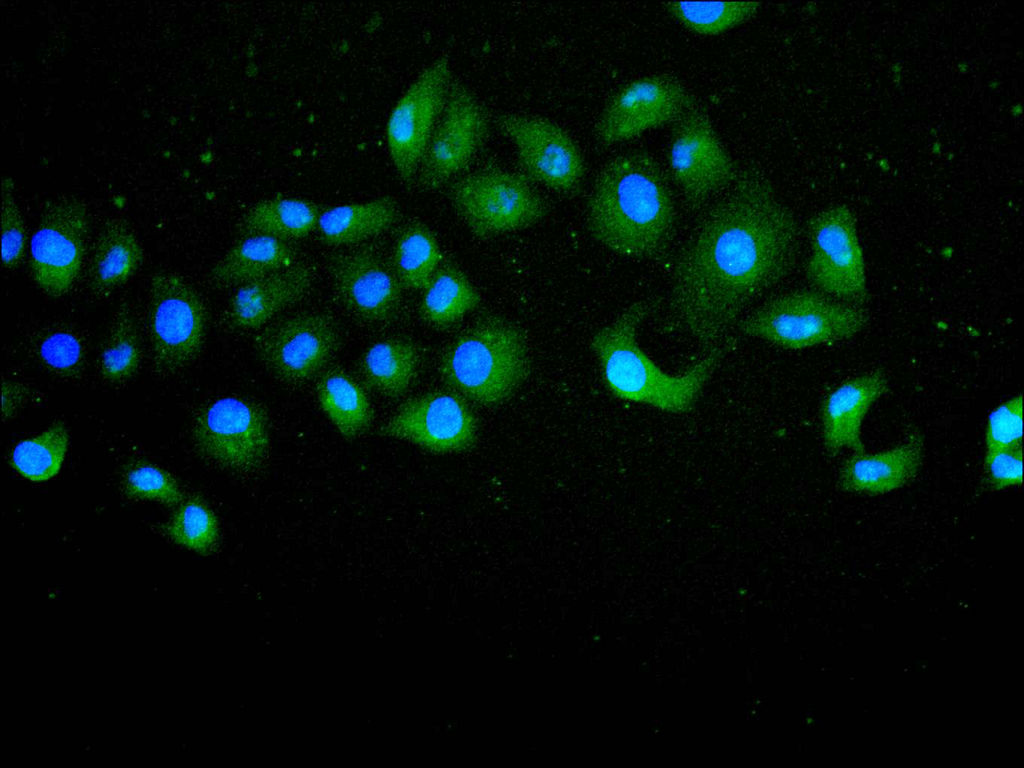 ImmunofluorescenceÂ stainingÂ ofÂ HelaÂ cellÂ withÂ atÂ 1:10,Â counter-stainedÂ withÂ DAPI.Â TheÂ cellsÂ wereÂ fixedÂ inÂ 4%Â formaldehydeÂ andÂ blockedÂ inÂ 10%Â normalÂ GoatÂ Serum.Â TheÂ cellsÂ wereÂ thenÂ incubatedÂ withÂ theÂ antibodyÂ overnightÂ atÂ 4C.Â TheÂ secondaryÂ antibodyÂ wasÂ FITC-conjugatedÂ AffiniPureÂ GoatÂ Anti-MouseÂ IgG(H+L).