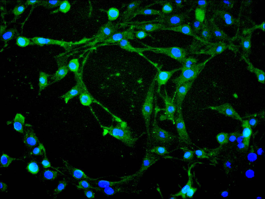 ImmunofluorescenceÂ stainingÂ ofÂ MCF7Â cellÂ withÂ atÂ 1:10,Â counter-stainedÂ withÂ DAPI.Â TheÂ cellsÂ wereÂ fixedÂ inÂ 4%Â formaldehydeÂ andÂ blockedÂ inÂ 10%Â normalÂ GoatÂ Serum.Â TheÂ cellsÂ wereÂ thenÂ incubatedÂ withÂ theÂ antibodyÂ overnightÂ atÂ 4C.Â TheÂ secondaryÂ antibodyÂ wasÂ FITC-conjugatedÂ AffiniPureÂ GoatÂ Anti-MouseÂ IgG(H+L).