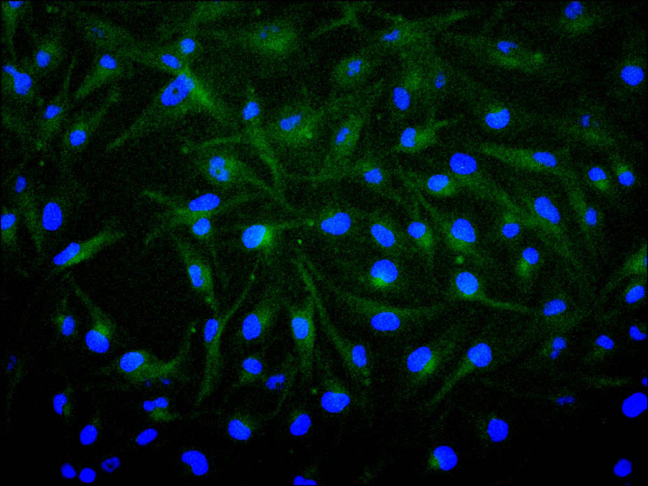 ImmunofluorescenceÂ stainingÂ ofÂ U251Â cellÂ atÂ 1:200,Â counter-stainedÂ withÂ DAPI.Â TheÂ cellsÂ wereÂ fixedÂ inÂ 4%Â formaldehydeÂ andÂ blockedÂ inÂ 10%Â normalÂ GoatÂ Serum.Â TheÂ cellsÂ wereÂ thenÂ incubatedÂ withÂ theÂ antibodyÂ overnightÂ atÂ 4C.Â TheÂ secondaryÂ antibodyÂ wasÂ FITC-conjugatedÂ AffiniPureÂ GoatÂ Anti-MouseÂ IgG(H+L).