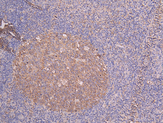 IHC image diluted at 1:200 and staining in paraffin-embedded human tonsil tissue performed on a Leica BondTM system. After dewaxing and hydration, antigen retrieval was mediated by high pressure in a citrate buffer (pH 6.0). Section was blocked with 10% normal goat serum 30min at RT. Then primary antibody (1% BSA) was incubated at 4Â°C overnight. The primary is detected by a Goat anti-human polymer IgG labeled by HRP and visualized using 0.05% DAB.
