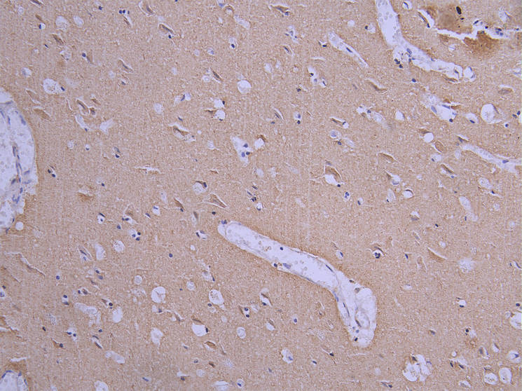 IHC image diluted at 1:200 and staining in paraffin-embedded human brain tissue performed on a Leica BondTM system. After dewaxing and hydration, antigen retrieval was mediated by high pressure in a citrate buffer (pH 6.0). Section was blocked with 10% normal goat serum 30min at RT. Then primary antibody (1% BSA) was incubated at 4Â°C overnight. The primary is detected by a Goat anti-human polymer IgG labeled by HRP and visualized using 0.05% DAB.