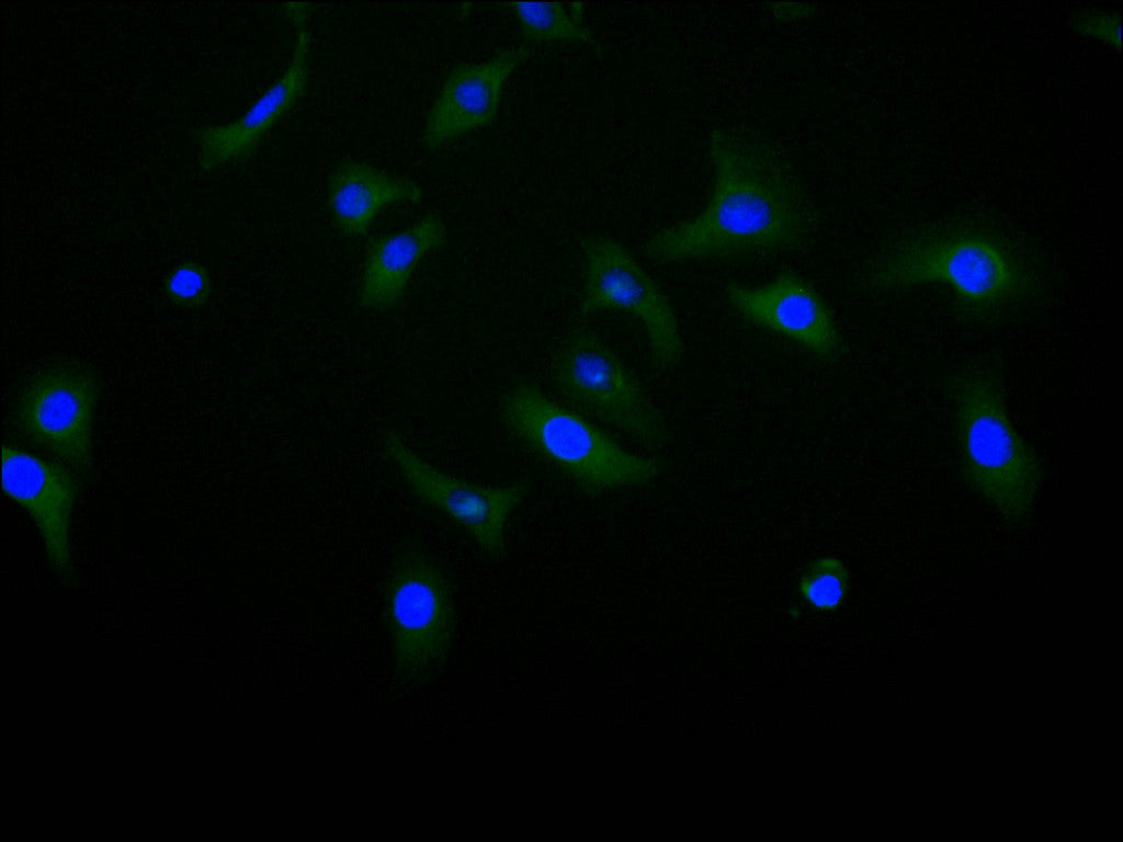 ImmunofluorescenceÂ stainingÂ ofÂ HelaÂ cellÂ atÂ 1:10,Â counter-stainedÂ withÂ DAPI.Â TheÂ cellsÂ wereÂ fixedÂ inÂ 4%Â formaldehydeÂ andÂ blockedÂ inÂ 10%Â normalÂ GoatÂ Serum.Â TheÂ cellsÂ wereÂ thenÂ incubatedÂ withÂ theÂ antibodyÂ overnightÂ atÂ 4C.Â TheÂ secondaryÂ antibodyÂ wasÂ FITC-conjugatedÂ AffiniPureÂ GoatÂ Anti-HumanÂ IgG(H+L).