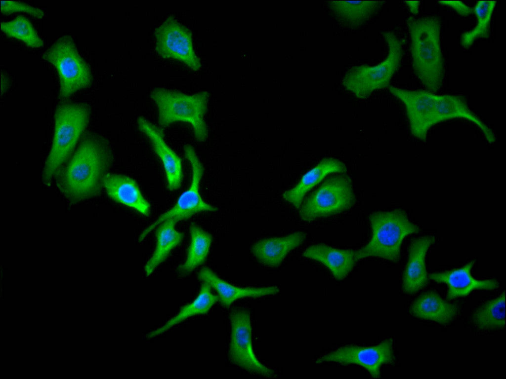 ImmunofluorescenceÂ stainingÂ ofÂ HelaÂ cellÂ atÂ 1:30,Â counter-stainedÂ withÂ DAPI.Â TheÂ cellsÂ wereÂ fixedÂ inÂ 4%Â formaldehydeÂ andÂ blockedÂ inÂ 10%Â normalÂ GoatÂ Serum.Â TheÂ cellsÂ wereÂ thenÂ incubatedÂ withÂ theÂ antibodyÂ overnightÂ atÂ 4C.Â TheÂ secondaryÂ antibodyÂ wasÂ FITC-conjugatedÂ AffiniPureÂ GoatÂ Anti-HumanÂ IgG(H+L).