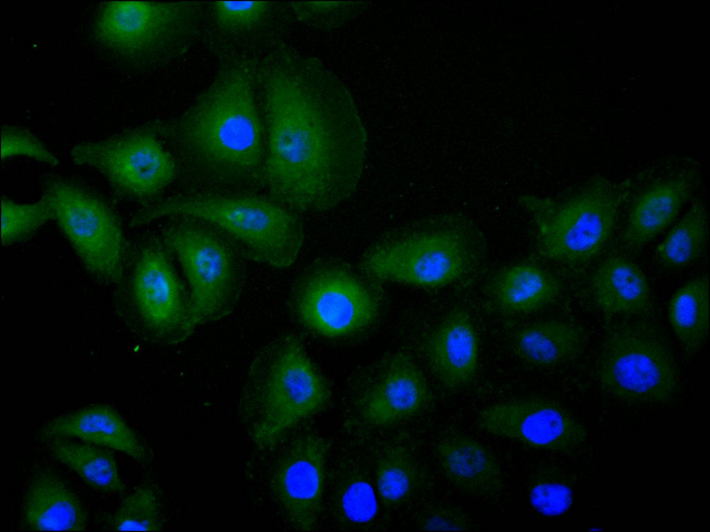 ImmunofluorescenceÂ stainingÂ ofÂ A549Â cellÂ atÂ 1:30,Â counter-stainedÂ withÂ DAPI.Â TheÂ cellsÂ wereÂ fixedÂ inÂ 4%Â formaldehydeÂ andÂ blockedÂ inÂ 10%Â normalÂ GoatÂ Serum.Â TheÂ cellsÂ wereÂ thenÂ incubatedÂ withÂ theÂ antibodyÂ overnightÂ atÂ 4C.Â TheÂ secondaryÂ antibodyÂ wasÂ FITC-conjugatedÂ AffiniPureÂ GoatÂ Anti-HumanÂ IgG(H+L).