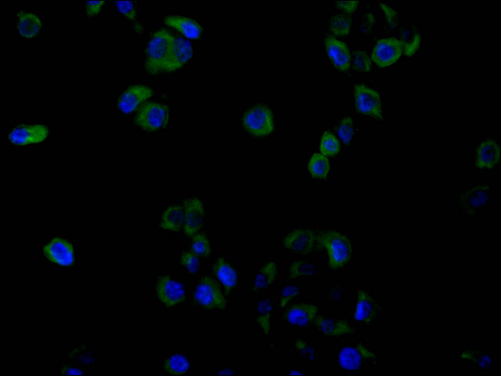 ImmunofluorescenceÂ stainingÂ ofÂ HelaÂ cellÂ atÂ 1:30,Â counter-stainedÂ withÂ DAPI.Â TheÂ cellsÂ wereÂ fixedÂ inÂ 4%Â formaldehydeÂ andÂ blockedÂ inÂ 10%Â normalÂ GoatÂ Serum.Â TheÂ cellsÂ wereÂ thenÂ incubatedÂ withÂ theÂ antibodyÂ overnightÂ atÂ 4C.Â TheÂ secondaryÂ antibodyÂ wasÂ FITC-conjugatedÂ AffiniPureÂ GoatÂ Anti-HumanÂ IgG(H+L).