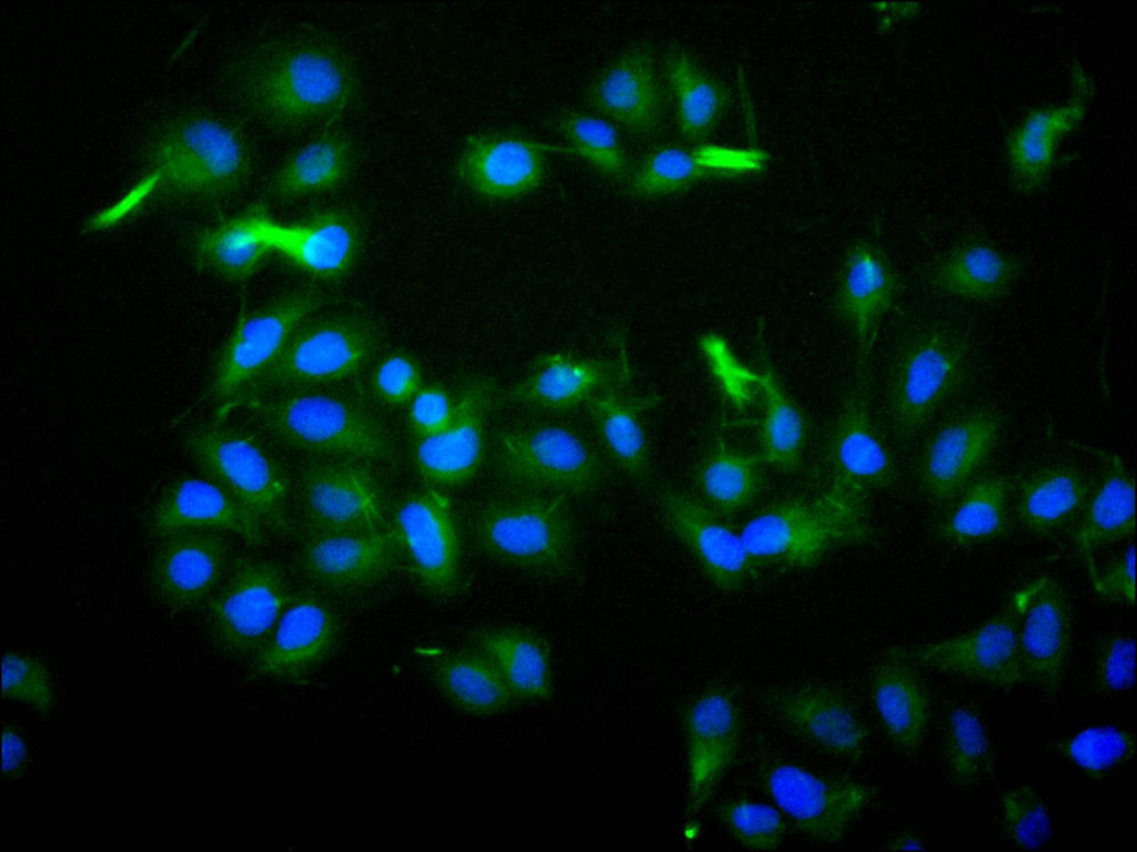 ImmunofluorescenceÂ stainingÂ ofÂ HelaÂ cellÂ atÂ 1:30,Â counter-stainedÂ withÂ DAPI.Â TheÂ cellsÂ wereÂ fixedÂ inÂ 4%Â formaldehydeÂ andÂ blockedÂ inÂ 10%Â normalÂ GoatÂ Serum.Â TheÂ cellsÂ wereÂ thenÂ incubatedÂ withÂ theÂ antibodyÂ overnightÂ atÂ 4C.Â TheÂ secondaryÂ antibodyÂ wasÂ FITC-conjugatedÂ AffiniPureÂ GoatÂ Anti-HumanÂ IgG(H+L).