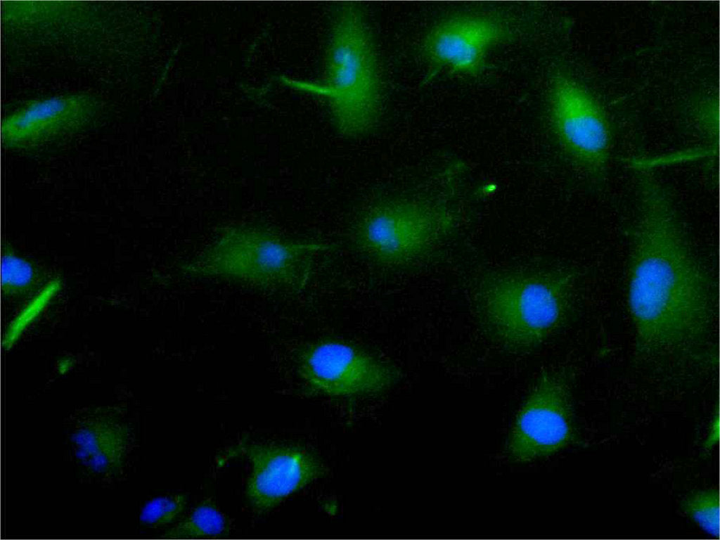 ImmunofluorescenceÂ stainingÂ of U251Â cellÂ atÂ 1:30,Â counter-stainedÂ withÂ DAPI.Â TheÂ cellsÂ wereÂ fixedÂ inÂ 4%Â formaldehydeÂ andÂ blockedÂ inÂ 10%Â normalÂ GoatÂ Serum.Â TheÂ cellsÂ wereÂ thenÂ incubatedÂ withÂ theÂ antibodyÂ overnightÂ atÂ 4C.Â TheÂ secondaryÂ antibodyÂ wasÂ FITC-conjugatedÂ AffiniPureÂ GoatÂ Anti-HumanÂ IgG(H+L).