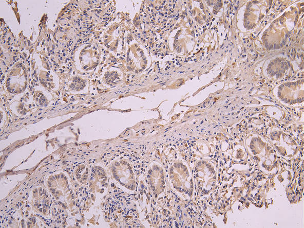 IHC image diluted at 1:200 and staining in paraffin-embedded human small intestine tissue performed on a Leica BondTM system. After dewaxing and hydration, antigen retrieval was mediated by high pressure in a citrate buffer (pH 6.0). Section was blocked with 10% normal goat serum 30min at RT. Then primary antibody (1% BSA) was incubated at 4Â°C overnight. The primary is detected by a Goat anti-human polymer IgG labeled by HRP and visualized using 0.05% DAB.