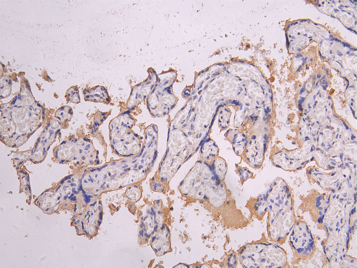 IHC image diluted at 1:200 and staining in paraffin-embedded human placenta tissue performed on a Leica BondTM system. After dewaxing and hydration, antigen retrieval was mediated by high pressure in a citrate buffer (pH 6.0). Section was blocked with 10% normal goat serum 30min at RT. Then primary antibody (1% BSA) was incubated at 4Â°C overnight. The primary is detected by a Goat anti-human polymer IgG labeled by HRP and visualized using 0.05% DAB.