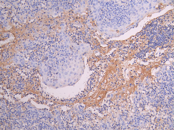 IHC image diluted at 1:150 and staining in paraffin-embedded human tonsil tissue performed on a Leica BondTM system. After dewaxing and hydration, antigen retrieval was mediated by high pressure in a citrate buffer (pH 6.0). Section was blocked with 10% normal goat serum 30min at RT. Then primary antibody (1% BSA) was incubated at 4Â°C overnight. The primary is detected by a Goat anti-human polymer IgG labeled by HRP and visualized using 0.05% DAB.