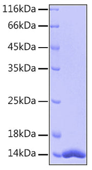 Recombinant Human FABP4/A-FABP/ALBP Protein