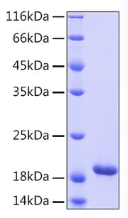 Recombinant Human IL-33 Protein