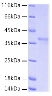 Recombinant Human IkB-alpha/NFKBIA Protein