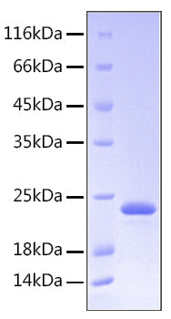 Recombinant Human Somatotropin/GH-N/GH1 Protein