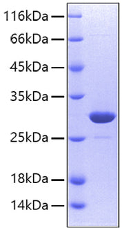 Recombinant Human Carbonic anhydrase 2 Protein