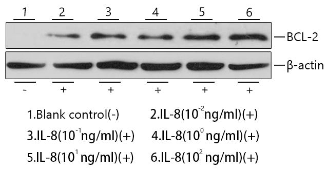 Recombinant Human IL-8/CXCL8/GCP-1 Protein