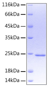 Recombinant Human Oncostatin-M/OSM Protein